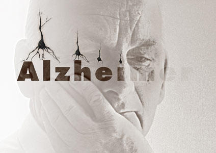 Gestione del paziente Alzheimer (crediti ECM 15)