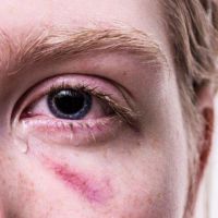 Teen Dating Violence
