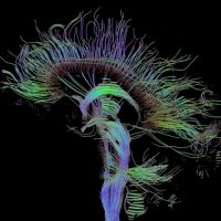 La Riabilitazione Neuropsicologica dell'adulto e dell'anziano.