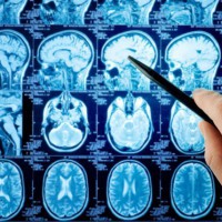 La valutazione neurologica dell'adulto e dell'anziano